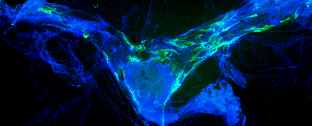 Clearing Brain Waste Dramatically Improves Memory in Aging Mice - ScienceAlert